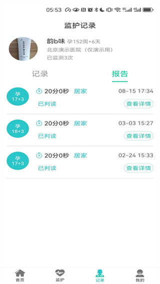 胎心监护截图4