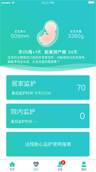 胎心监护截图5