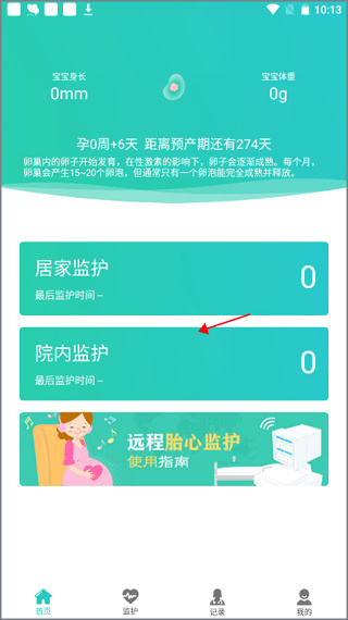 胎心监护